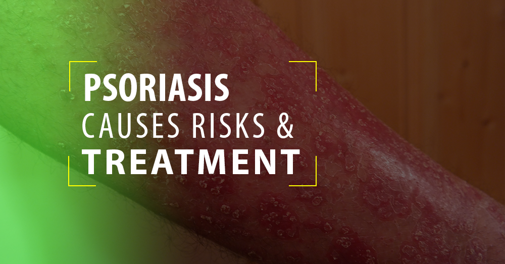 Psoriasis Causes Risks And Ayurveda Treatment Kerala India